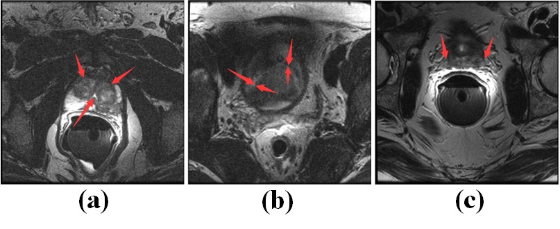 1-1PF2092JQP.jpg 1-1PF2092JQP.jpg