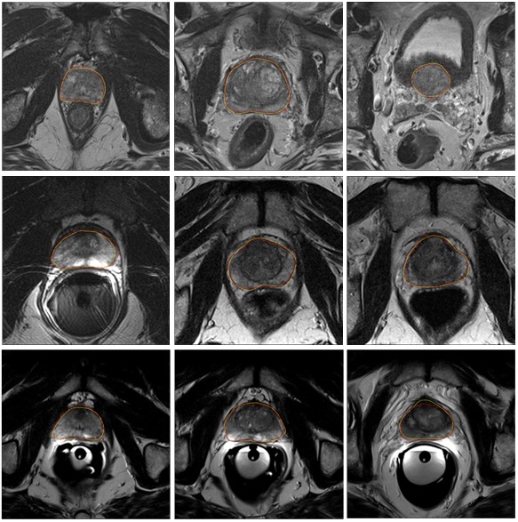 1-1PF2092Q33R.jpg 1-1PF2092Q33R.jpg
